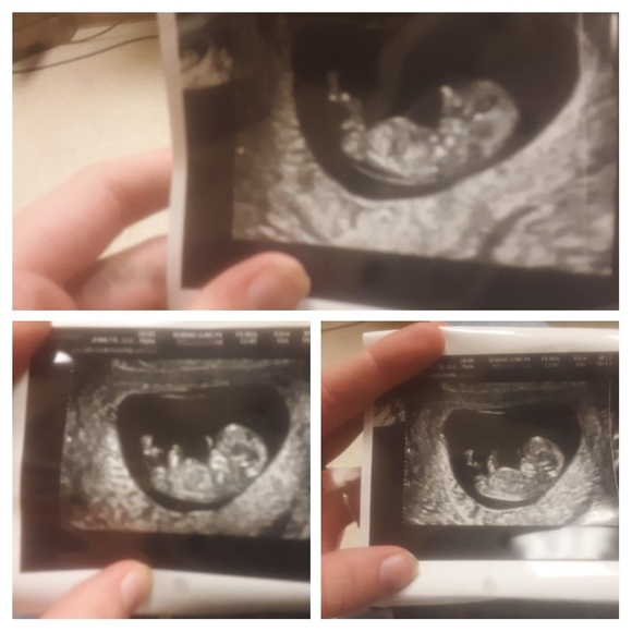 Meet your Posher, Clowie - Picture 1 of 1